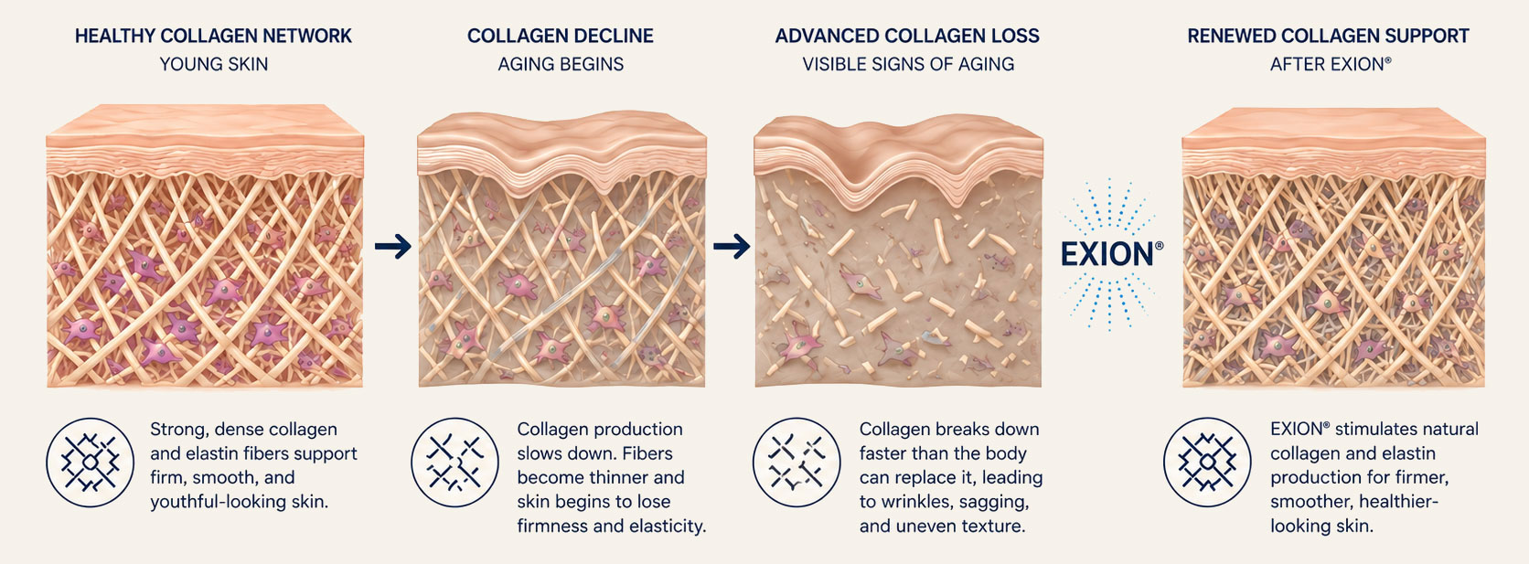 EXION collagen renewal